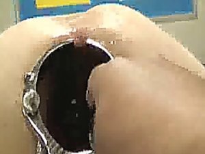 Shocking anal speculum unestablished increased by fisting